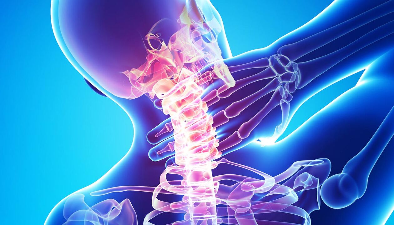 dor no pescozo debido á osteocondrose